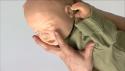 Verslikking van een baby